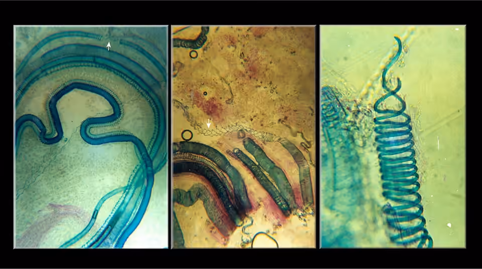 Éléments du xylème d’un figuier observés au microscope Éléments du xylème d’un figuier observés au microscope.