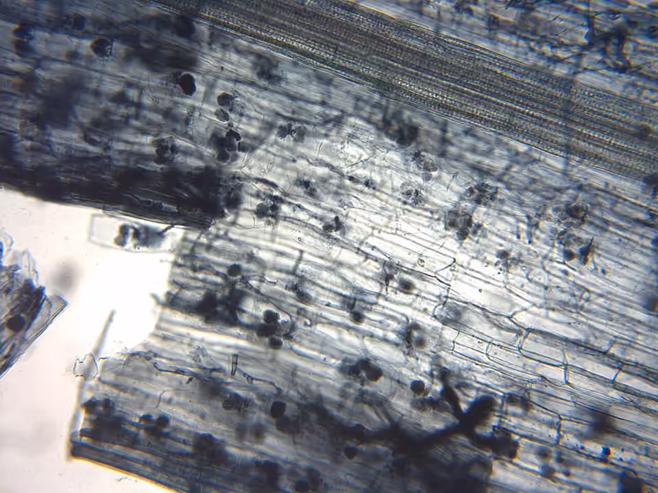 Racine de lin observée au microscope, avec des structures de champignons mycorhiziens dans ses cellules Racine de lin observée au microscope, avec des structures de champignons mycorhiziens dans ses cellules.